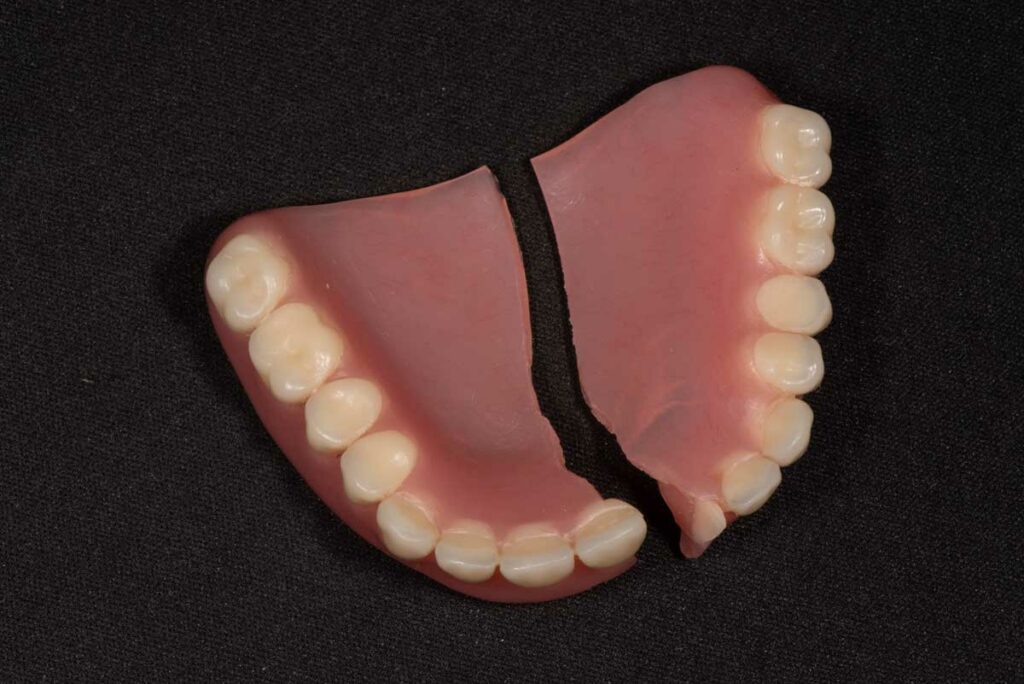 denture repair